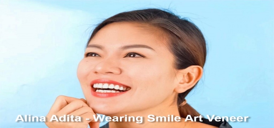 Keunggulan Smile Art sebagai Klinik Gigi Jakarta Terpercaya